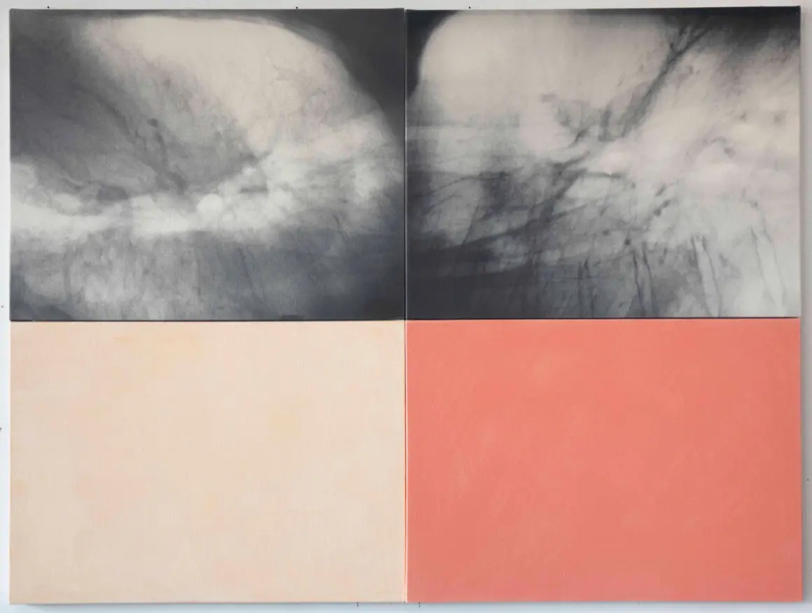 Kunié Sugiura, “Fever”, 2021, pigment print, acrylic on canvas, 106.6 x 142.2 cm © Kunié Sugiura / Courtesy of Taka Ishii Gallery